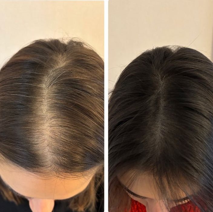 Haarpflegeserum HaarVital