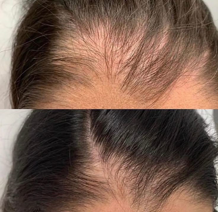 Haarpflegeserum HaarVital